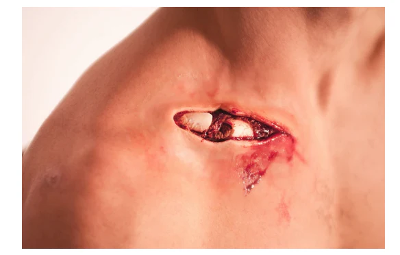 Exposed bone - B1 Silicone Prosthetic - Image 3