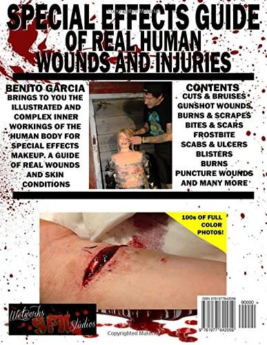Special Effects Guide Of Real Human Wounds and Injuries