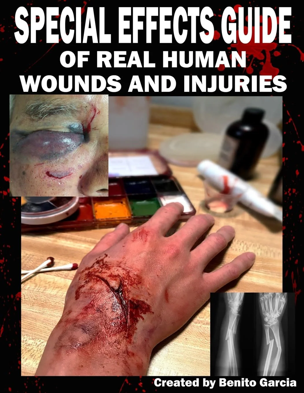 Special Effects Guide Of Real Human Wounds and Injuries - Image 2