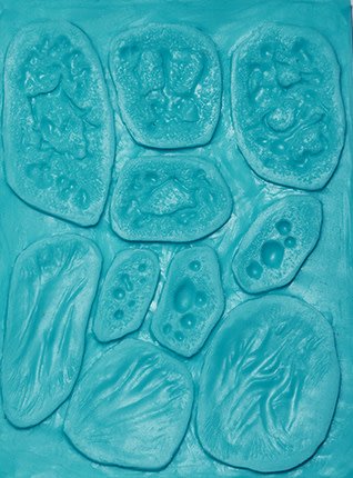 S.O.S.2 Molds Burns (3 Stages)