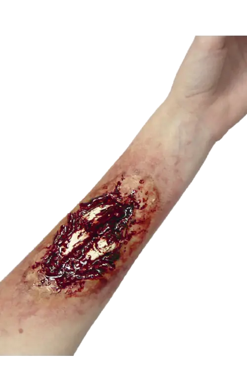 Latex Arm Appliance Broken Bone